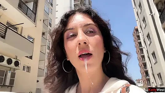 Kaybetti ve Yüzünde Dölle Yürümeye Mahkum Kaldı